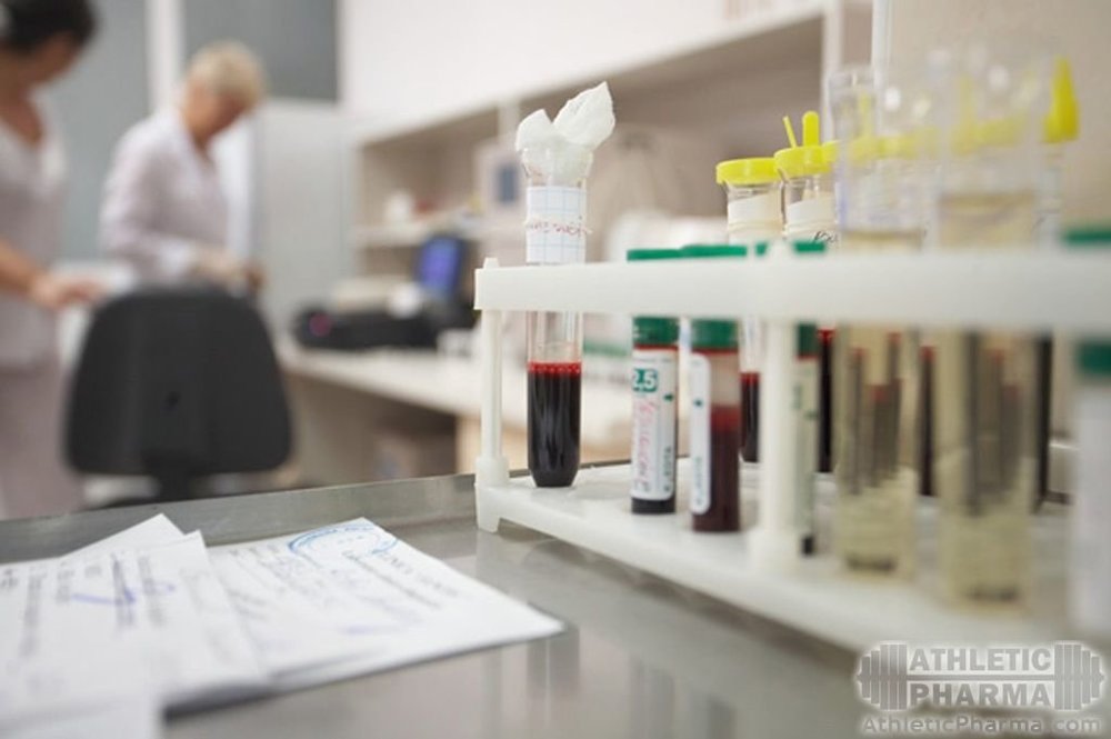 Анализ крови на ПТГ