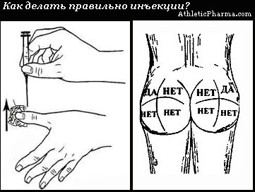 Как делать правильно инъекции?