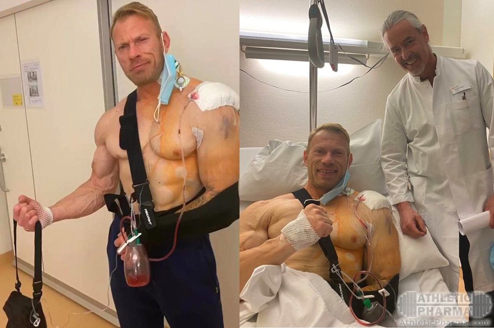 Денис Вольф после операции